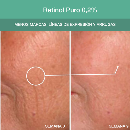 Retinol Advance Cápsulas: Serum de Retinol y Aceite de Macadamia contra Marcas, Arrugas y Acné