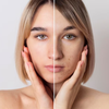 AzeBiome – Serum Corrector con Ácido Azelaico y CutiBiome CLR para Piel Acneica y Reactiva