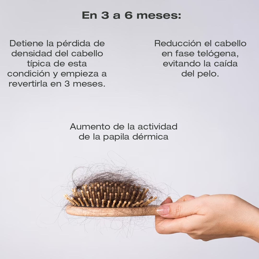 Tónico Capilar Anticaída con Follicusan DP para Estimular el Crecimiento y Prevenir la Caída