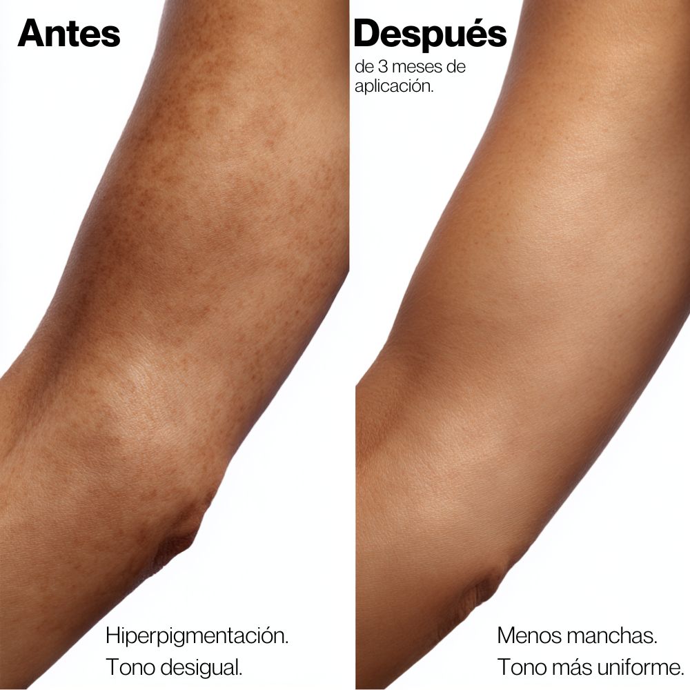 Crema Despigmentante Corporal e Íntima con Niacinamida y Ácido Kójico – Uniformiza el tono y reduce manchas