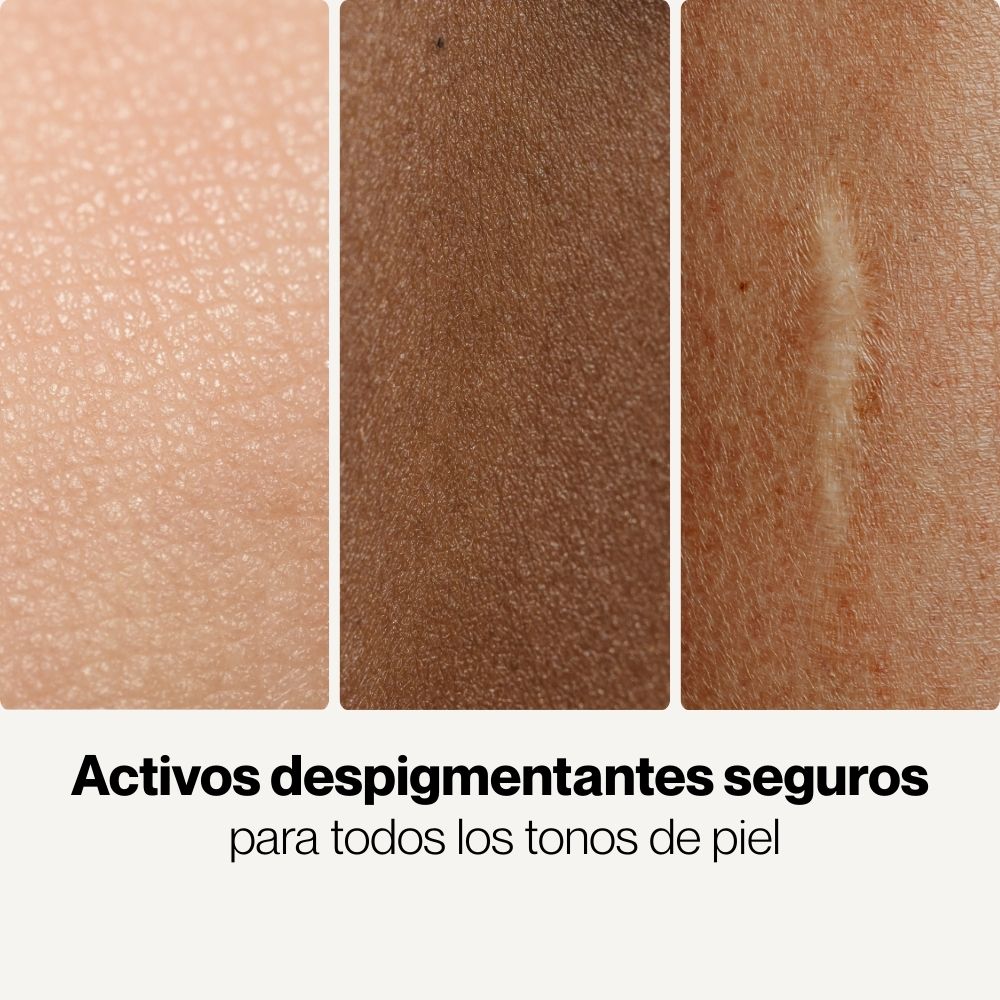 Crema Despigmentante Corporal e Íntima con Niacinamida y Ácido Kójico – Uniformiza el tono y reduce manchas