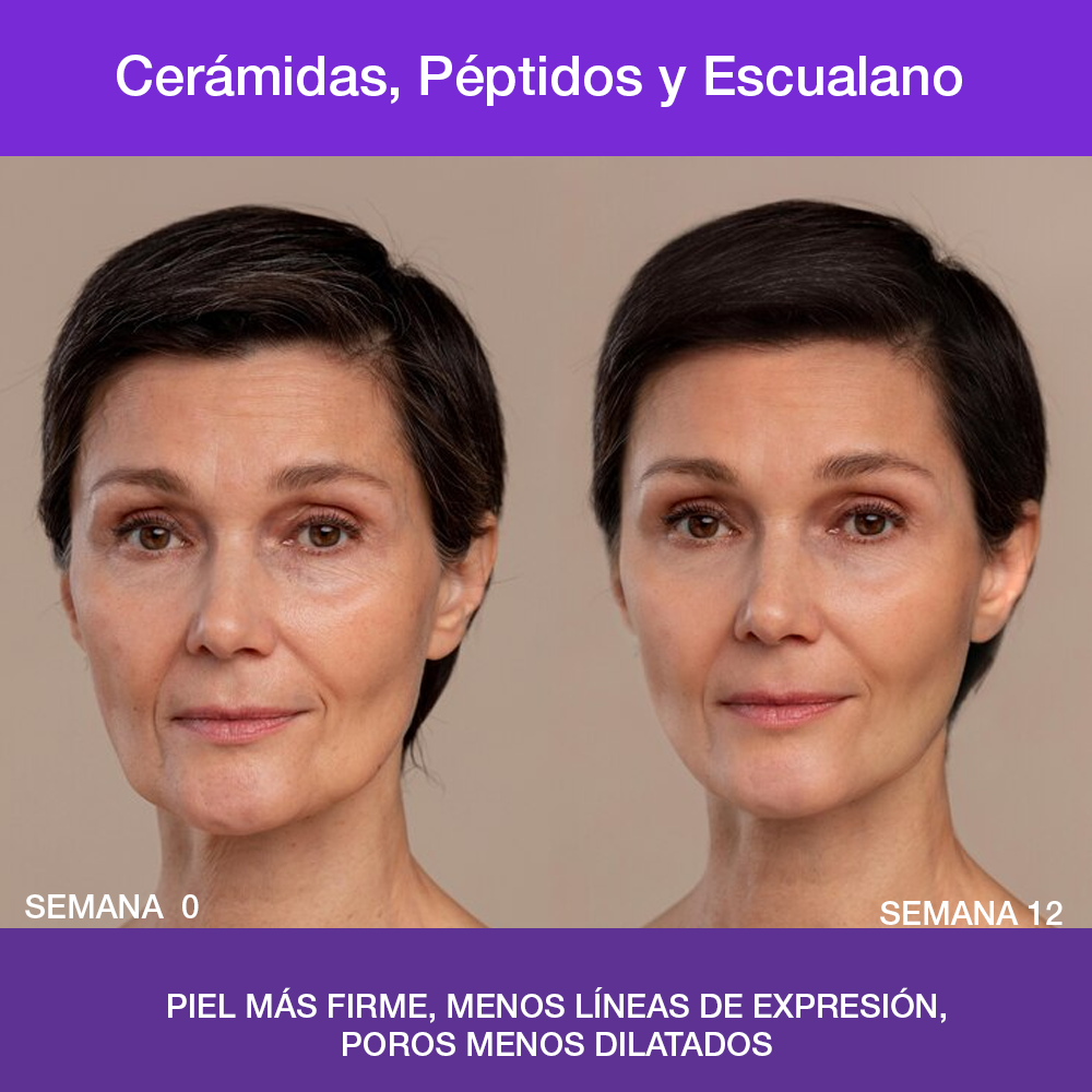 Cerablend Complex Capsulas – Serum Antiedad de Ceramidas y Péptidos Reafirmantes Ideal Piel Madura, Seca o Atópica
